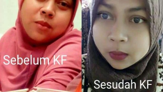 MENGUBAH LIFESTYLE MENJADI LEBIH BAIK