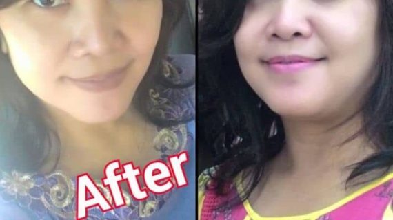 KARENA KETO, MATA BISA MELIHAT DENGAN JELAS