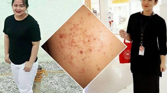 HAL LUAR BIASA YANG DI DAPAT SELAMA MENJALANI KETO