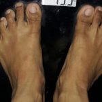 AKU KEMBALI SEPERTI GADIS REMAJA , SEJAK IKUT KETO