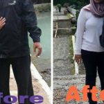 GERD SUAMIHILANG SEJAK KETOGENIC