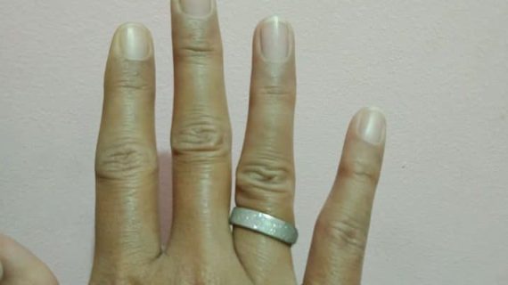 KETOGENIC BUAT CINCIN JADI LONGGAR