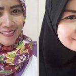 KETO BUAT WAJAH TERLIHAT LEBIH TIRUS