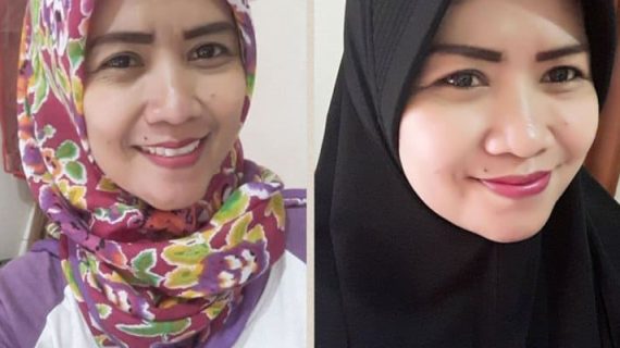 KETO BUAT WAJAH TERLIHAT LEBIH TIRUS