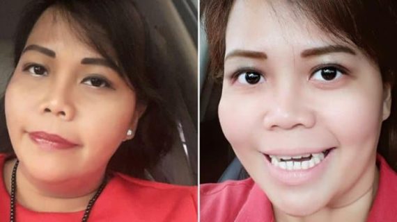 KETOGENIC BUAT SAYA JADI LEBIH SEHAT DAN TIDAK PERNAH SAKIT LAGI