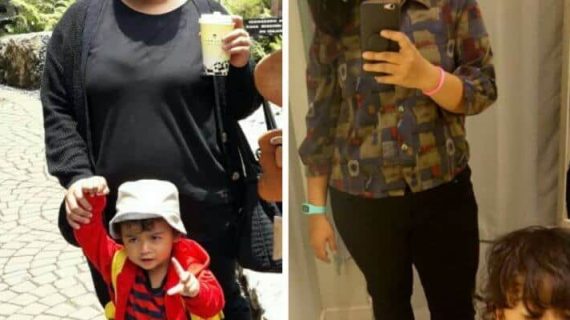 Perbandingan Sebelum dan Sesudah Keto