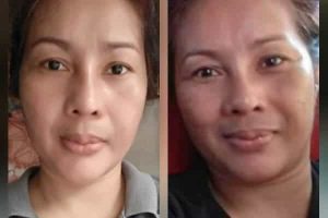 Pipi Tirus Dalam 3 Minggu