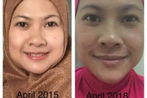 Lupakan BB Karena Saya Sekarang Dengan Kondisi Yang Lebih Fit