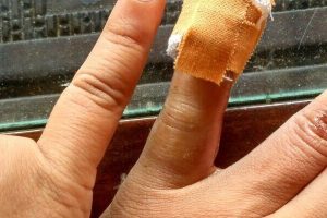 Progress Penyembuhan Sangat Cepat Dengan Keto