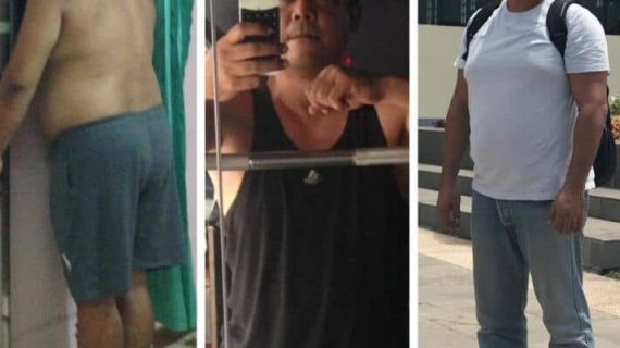 Bisa Sembuh Dari Struk Karna Keto