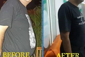 Ketergantungan Obat Diabetes Sudah Bisa Ditinggalkan