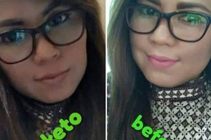 Migran Sudah Tidak Pernah Kambuh Lagi